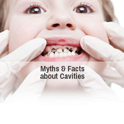 Myths and facts about cavities