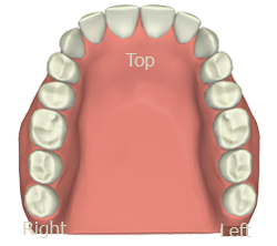 Interactive Meridian Tooth Chart App - Teeth Set